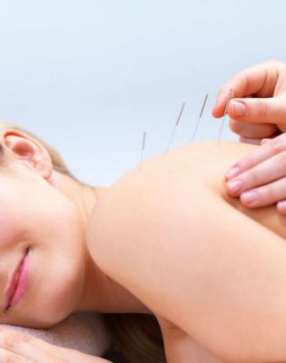 acupuncture-and-menopause--My-Menopause-Fix.jpg